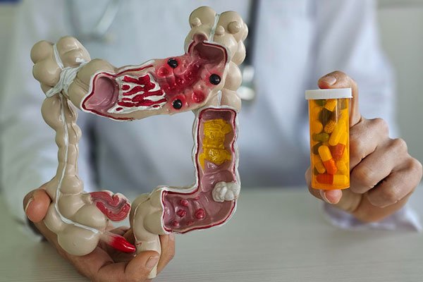 Gastro Medicines Available in Madurai